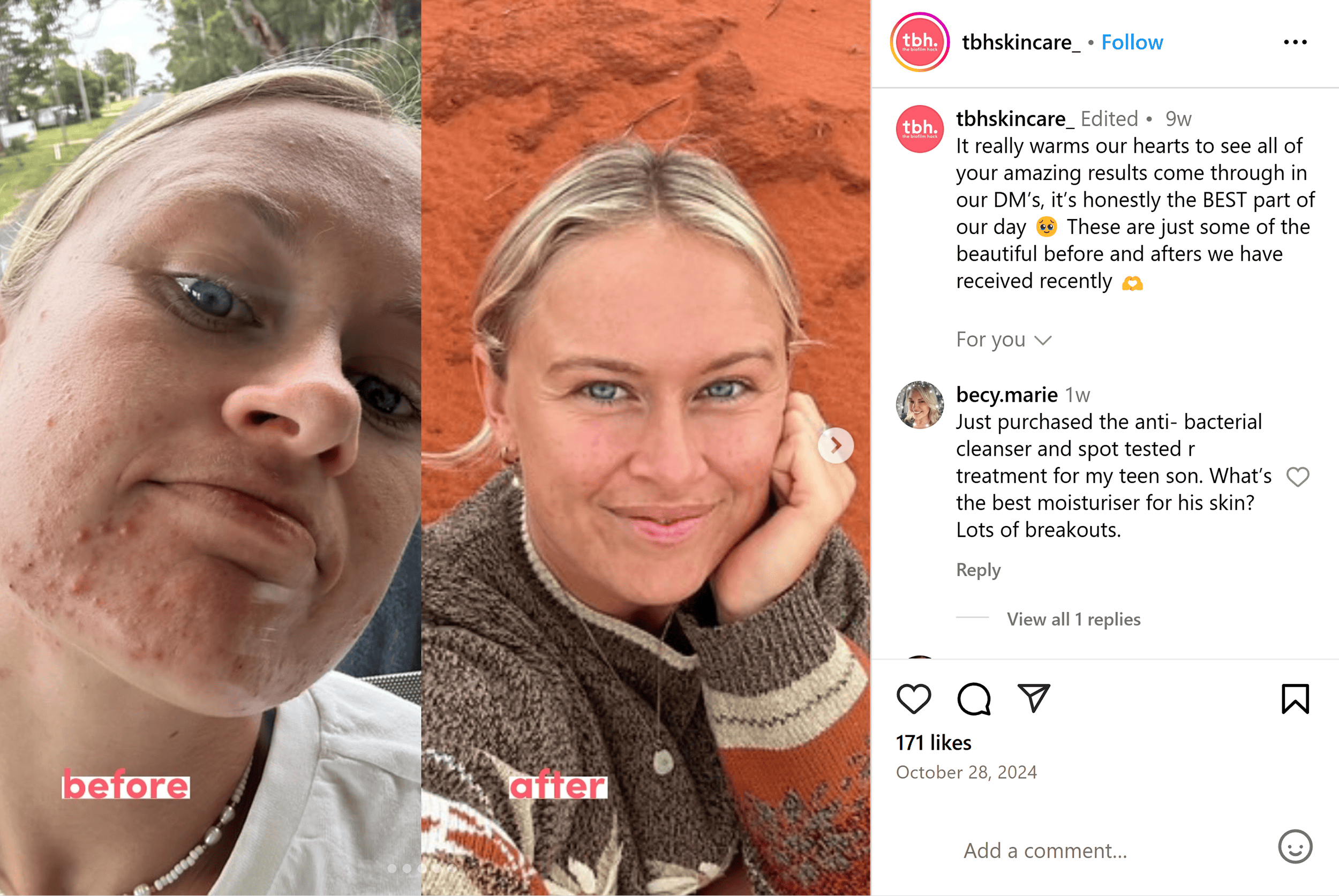 Instagram – tbh Skincare – Post